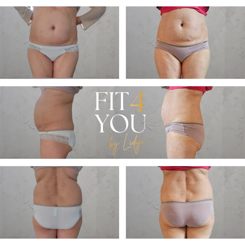 Vorher-Nachher Ergebnis 1