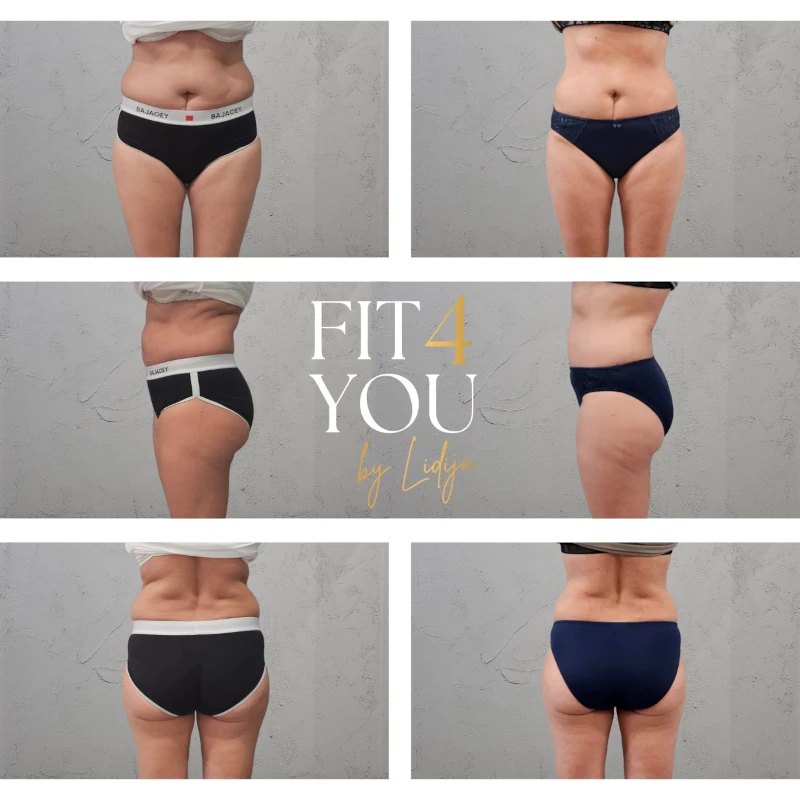 Vorher-Nachher Ergebnis 2